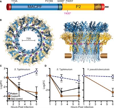 MPEG1/Perforin-2 Haploinsufficiency Associated Polymicrobial Skin Infections and Considerations for Interferon-γ Therapy